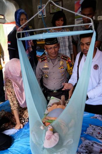 Bayi Delapan Bulan Di Pekanbaru Menderita Tumor Ganas