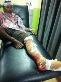 Warga Kampar Selamat Setelah Bergulat Dengan Buaya