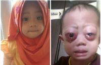Viral! Bayi mungil di Riau ini menderita penyakit langka