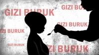 Ironis, 4 Kecamatan di Pekanbaru alami kasus gizi buruk 