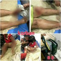 Dijambret, nenek dan cucunya jatuh berdarah-darah dari sepeda motor