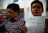 Buntut "deal" politik Pileg 2014, anggota DPRD Riau Yusuf S dipolisikan usai keroyok rekan se-partai