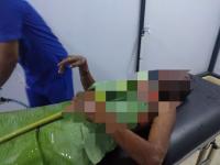 Sadis, Remaja Dibakar Akibat Dituduh Nyolong Kompor di Kampar