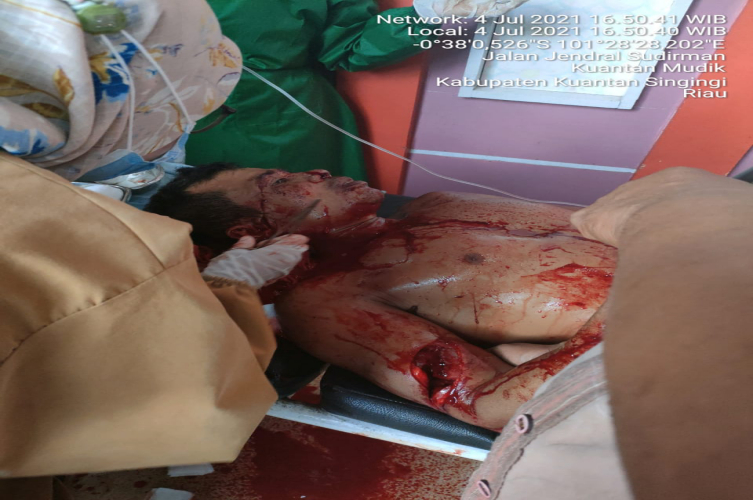 Penambang Emas di Kuansing Terkapar Bersimbah Darah
