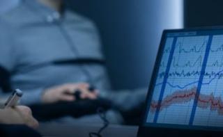 Kasus Dosen Incar Bibir, Syafri Harto Diperiksa Pakai Lie Detector