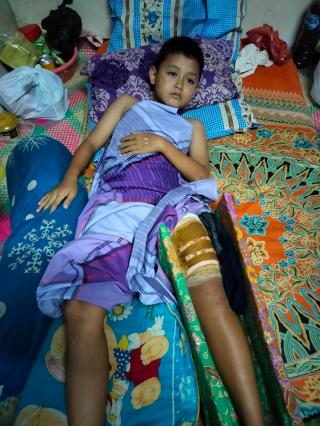 Alami Laka Lantas, Ayah Meninggal, Bocah di Bengkalis Ini Butuh Uluran Tangan Dermawan