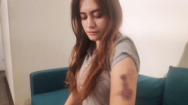 Tak Terima Dianiaya, Wanita Cantik Ini Laporkan Oknum Polwan dan Ibunya ke Polda Riau