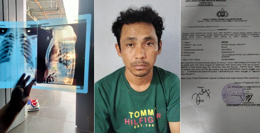Gegara Sawit, Dua Warga Kampar Dianiaya, Dipaksa Makan Cabai