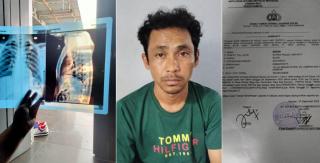 Gegara Sawit, Dua Warga Kampar Dianiaya, Dipaksa Makan Cabai