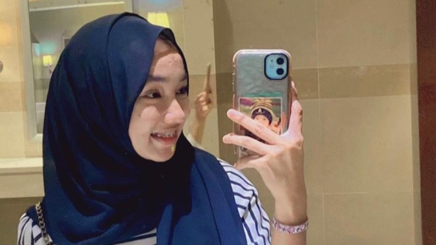 Ife Korban Gunung Marapi Meninggal Dunia Usai 13 Hari Dirawat di Rumah Sakit