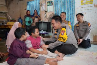 Dibiayai Kapolda Riau, Kondisi Kakak dan Adik Penderita Tulang Kaca Membaik