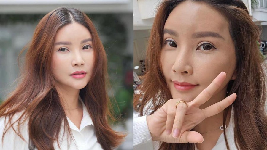 Ini Penampilan Terbaru Sarwendah Hasil Operasi Plastik di Korea