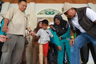 Afni Tepati Janji, Yuda Anak Disabilitas itu Kini Punya Kaki Palsu