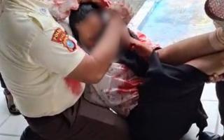 Rektor UIN Suska Riau Kecam Pembacokan Mahasiswi, Korban Dapat Pendampingan Penuh Kampus