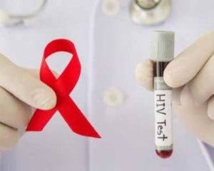 Kasus AIDS di Riau Didominasi Usia Produktif, Laki-laki Jadi Kelompok Tertinggi